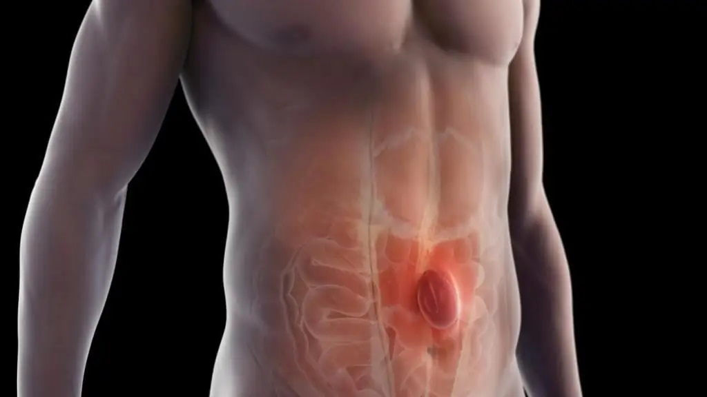 Hernia Treatment